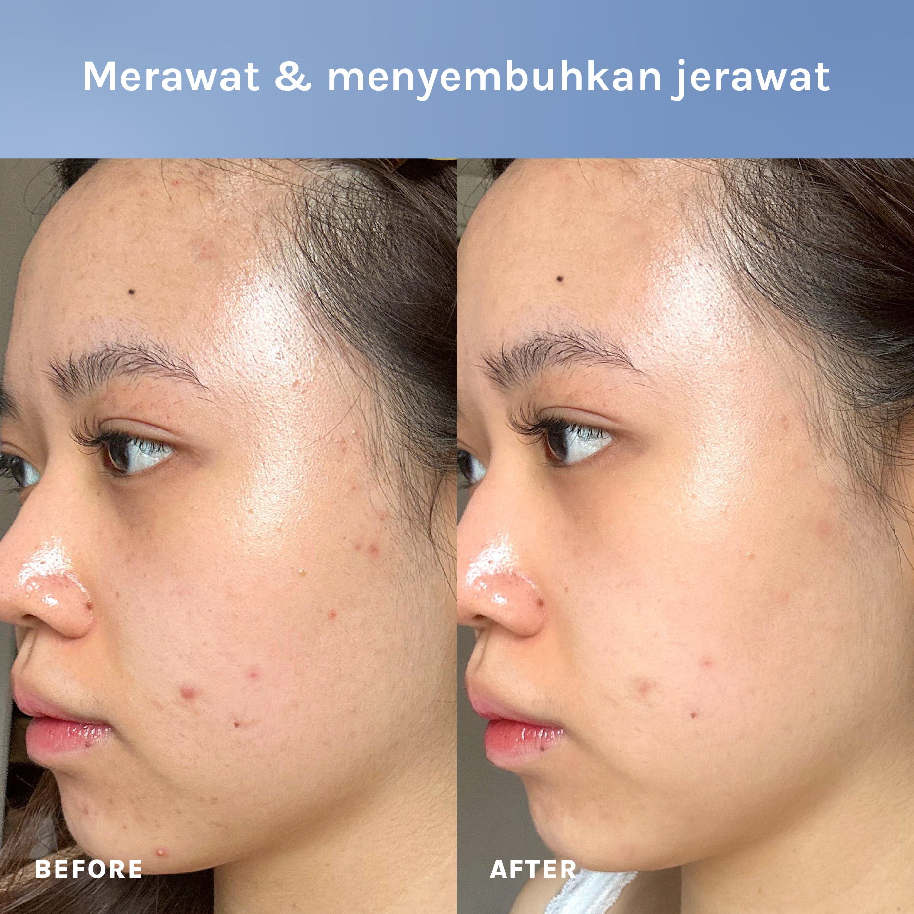 The Peptide + Ceramide Barrier Hero Cream - Feal
