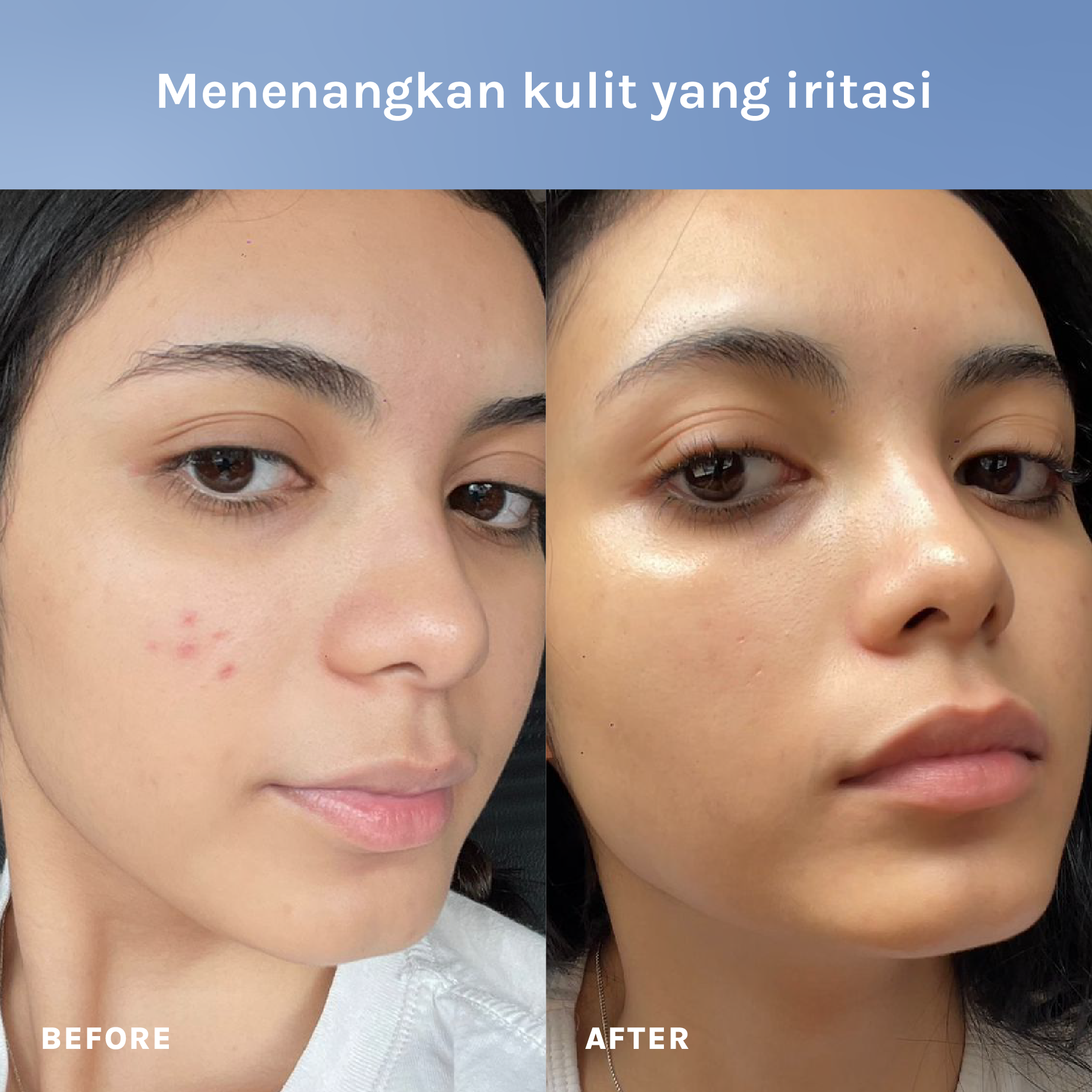 The Peptide + Ceramide Barrier Hero Cream - Feal