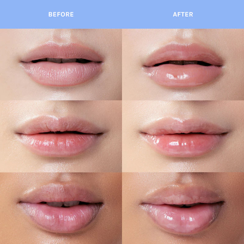 The Peptide Pillow Lip Treatment - Cloud Kiss - Feal